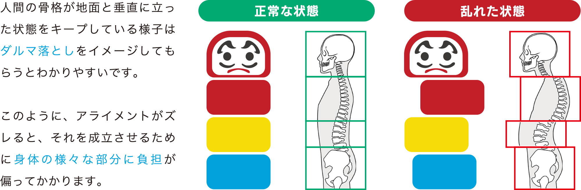 人間の骨格が地面と垂直に立った状態をキープしている様子はダルマ落としをイメージしてもらうとわかりやすいです。このように、アライメントがズレると、それを成立させるために身体の様々な部分に負担が偏ってかかります。